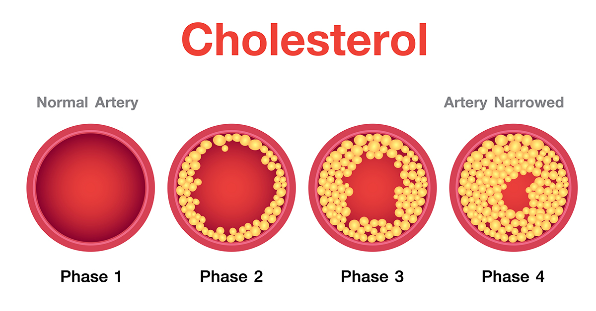  Cholestrol